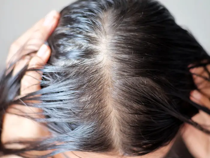 Does Dry Shampoo Cause Hair Loss? Separating Myth from Reality